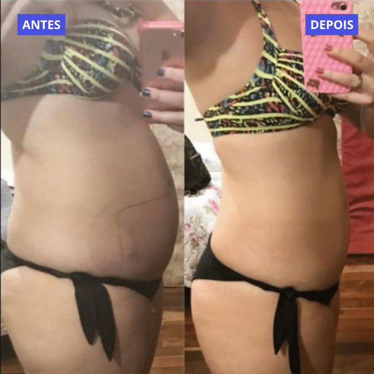 ANTES (1)