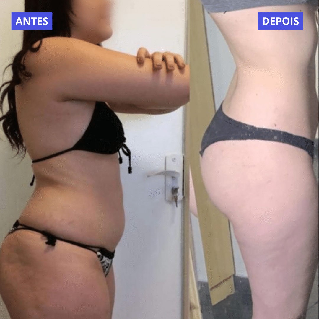 ANTES (10)