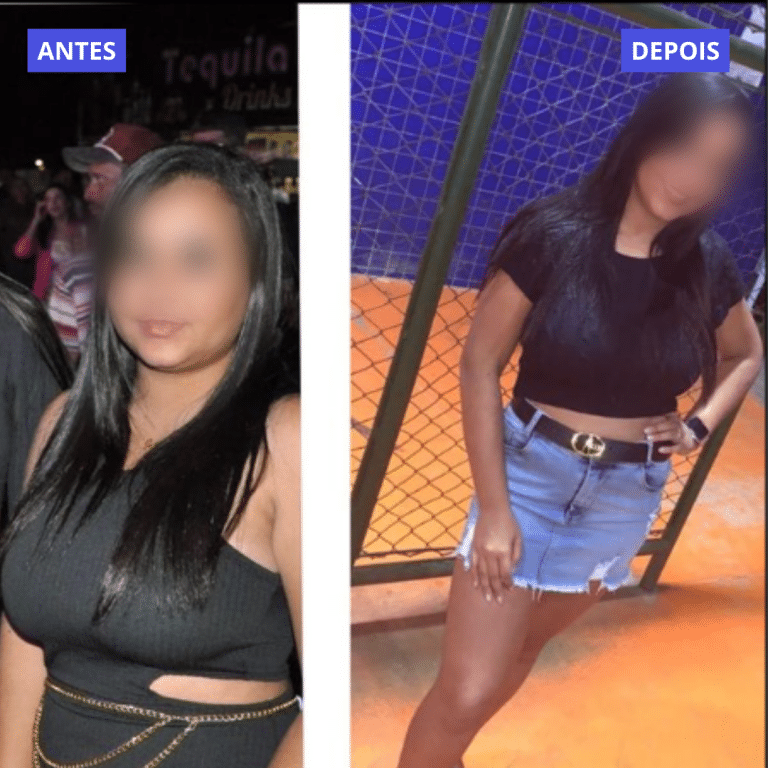 ANTES (11)