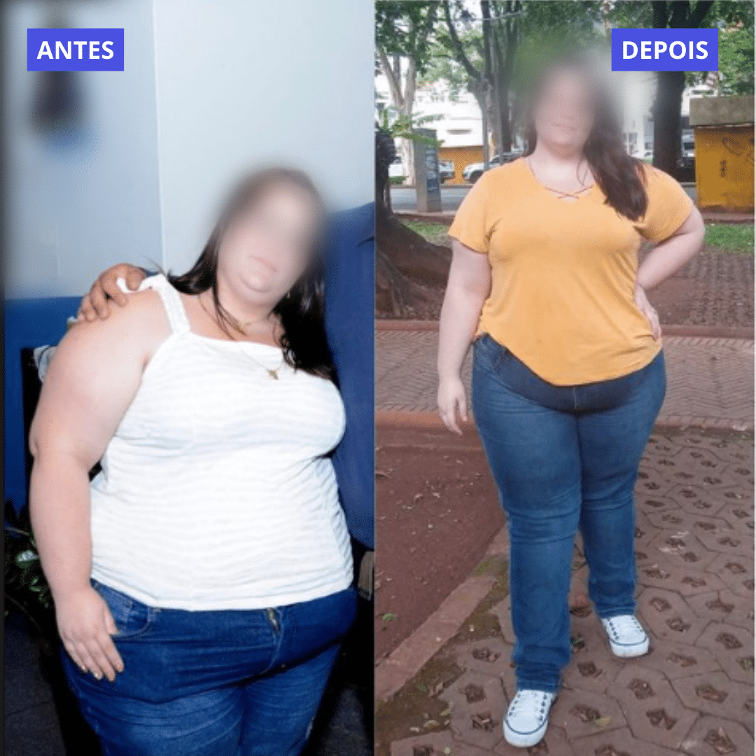 ANTES (12)
