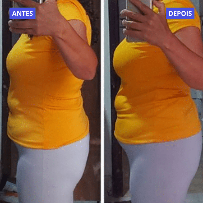 ANTES (4)